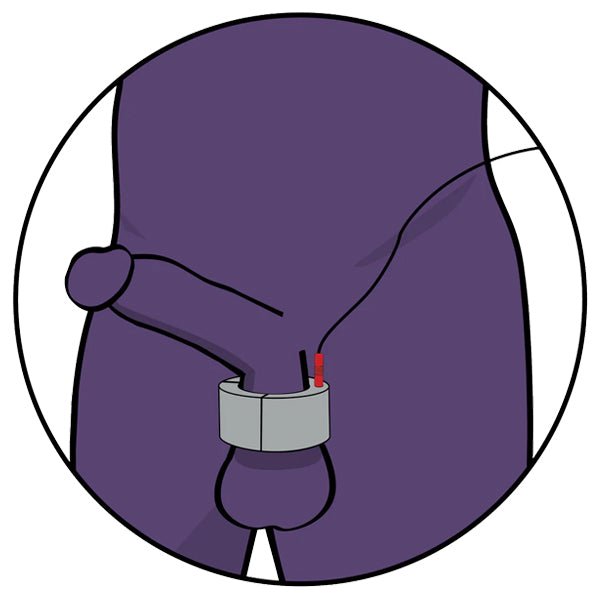 ElectraStim Electro Ball Stretcher - 20mm