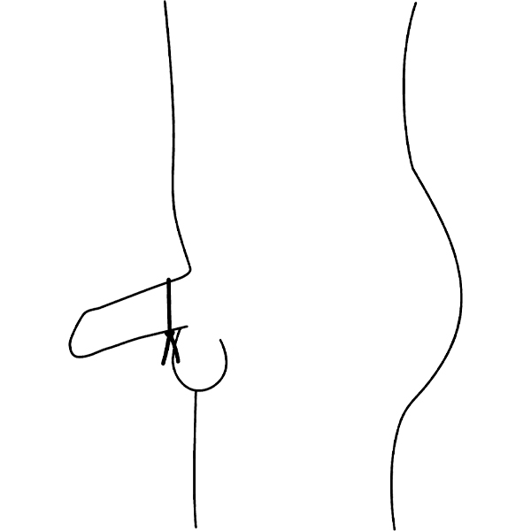 rotato image